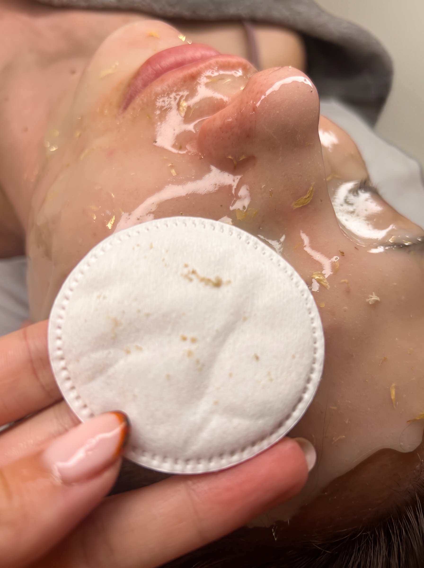 Advanced Aesthetics Clinic in Croydon London